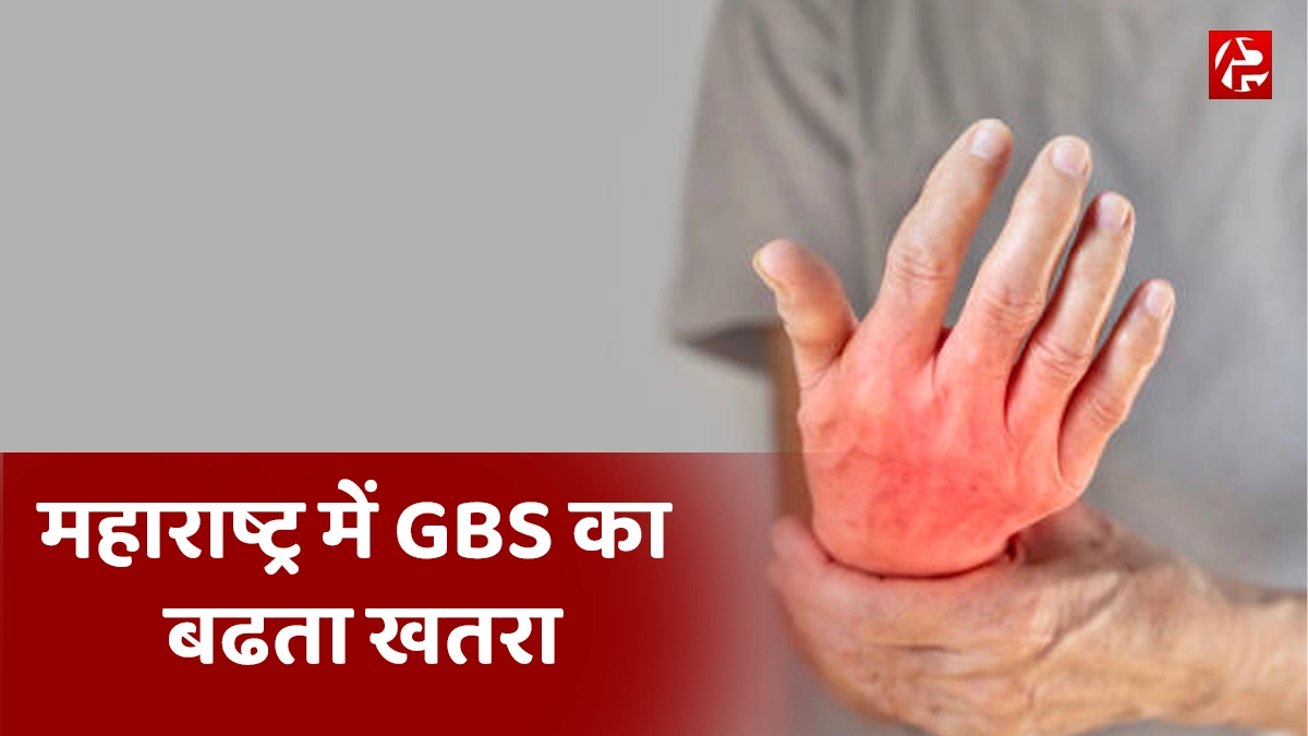 Guillain-Barre Syndrome: पुणे में जीबीएस के 100+ मामले, उपमुख्यमंत्री ने की मुफ्त इलाज की घोषणा